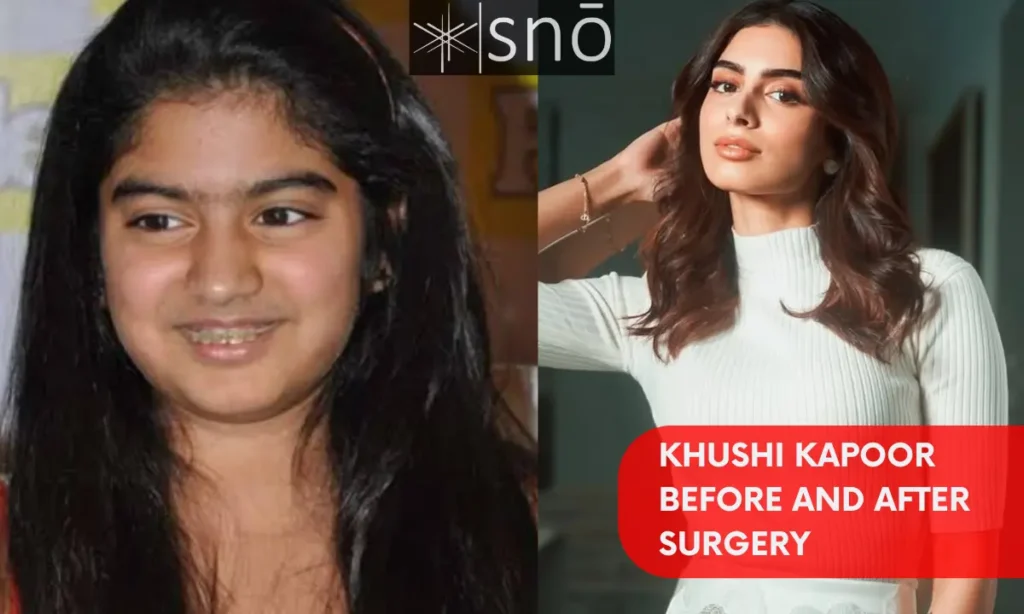 Khushi Kapoor Before and After Surgery